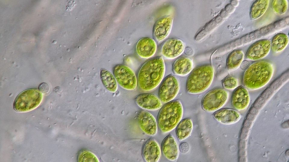 Zelená řasa Scotiellopsis