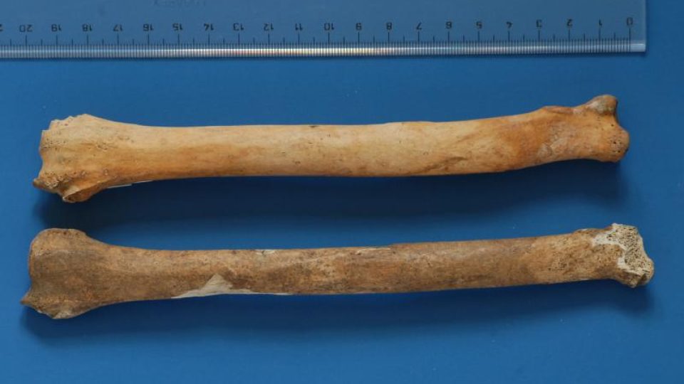 Pohled na vřetenní kost chrta (dole) ve srovnání s vřetenní kostí stejně velkého psa (nahoře)