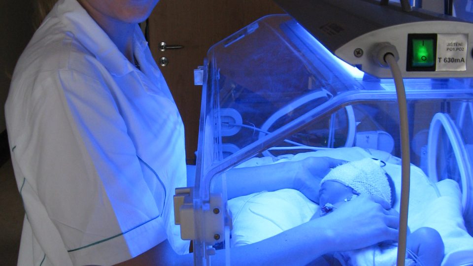  Modré světlo v inkubátoru značí takzvanou fototerapii