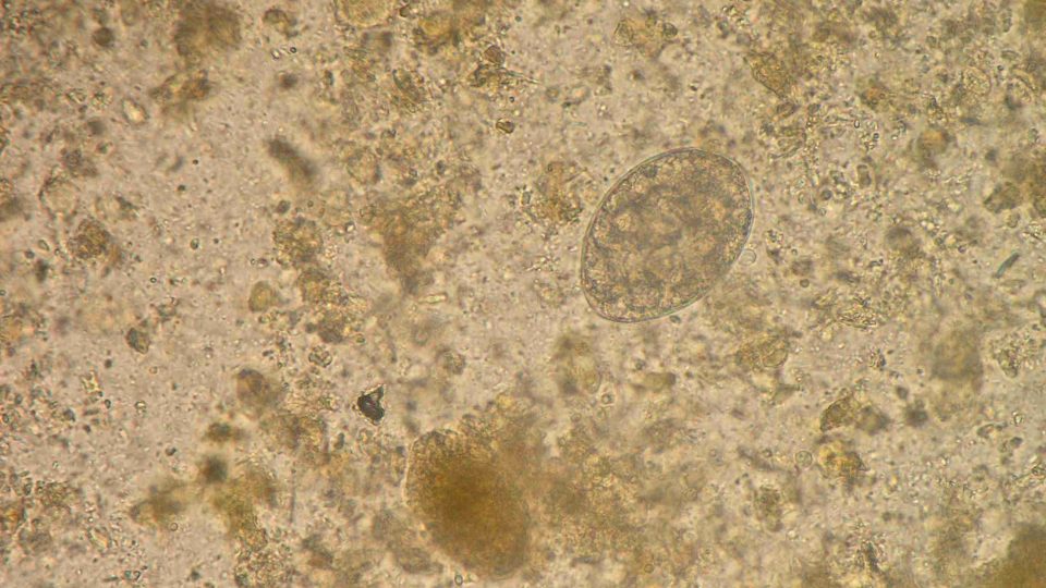 Vyšetření stolice a nález vajíček škulovce širokého (tasemnice z rodu Diphyllobothrium)