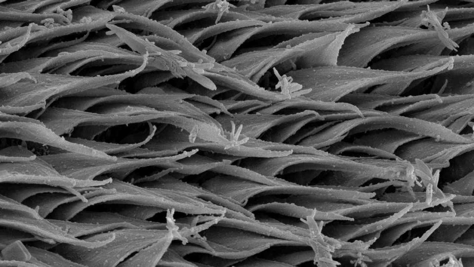 Chloupky (mikrotrichy) na povrchu těla tasemnice. 10 000krát zvětšený povrch tasemnice fotografovaný pomocí skenovacího elektronového mikroskopu