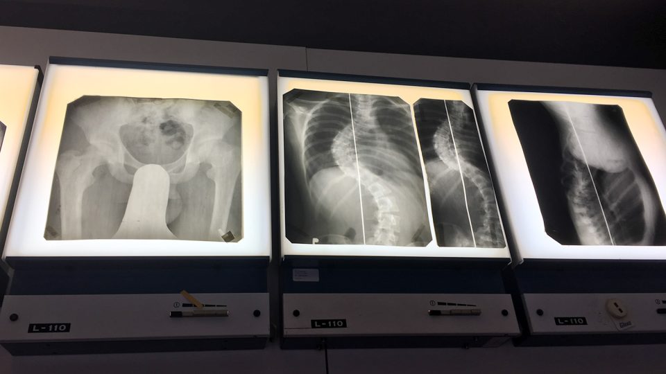 Staré rentgenové snímky z Hamzovy léčebny